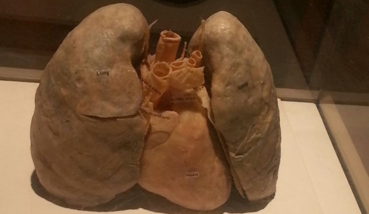 Ilustrační fotografie