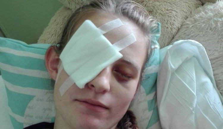 Hasičku Míšu zasáhl při soutěži na Olomoucku proud vody přímo do očí. Lékaři bojují o její zrak.