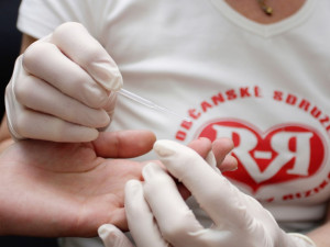 Za tři čtvrtletí se nakazilo HIV 162 lidí, o 32 méně než loni
