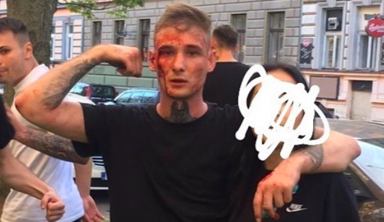 Jeden z aktérů po konfliktu u Žižkárny.