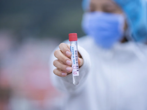 Česká firma chce na Tchaj-wan dodávat testy na koronavirus