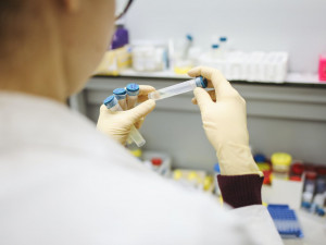 V Česku je podezření na výskyt britské mutace koronaviru