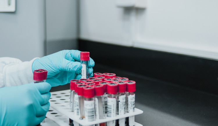 Za odměnu test na protilátky. Brněnská nemocnice nabízí bonus pro dárce krve