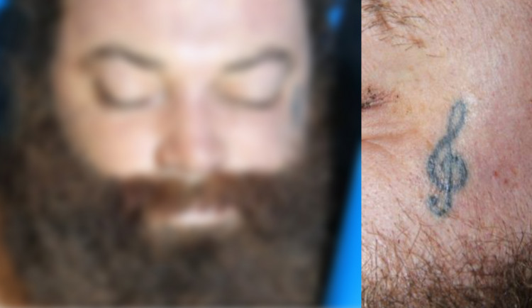 V pražské nemocnici zemřel neznámý muž. Na obličeji měl vytetovaný houslový klíč