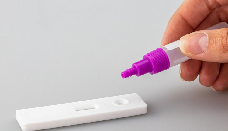 Na jižní Moravě padají denní rekordy, za týden přibylo přes 17 tisíc nakažených