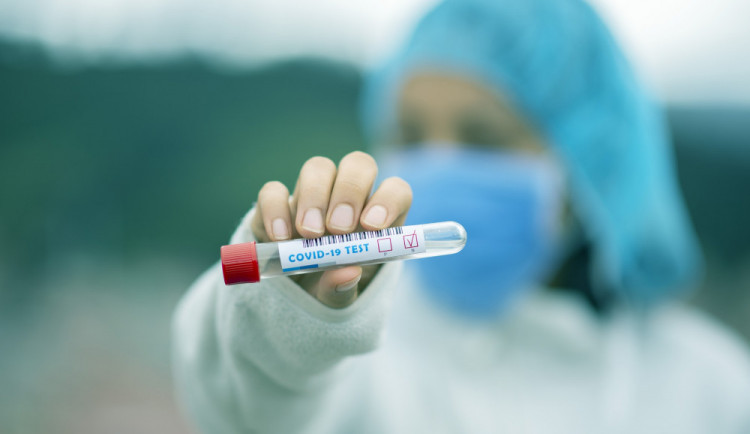 Ve středu přibylo 43 307 nově potvrzených případů covidu, méně než před týdnem