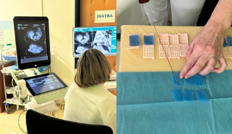 Ve Znojmě používají moderní metodu, která odhalí rakovinu prostaty