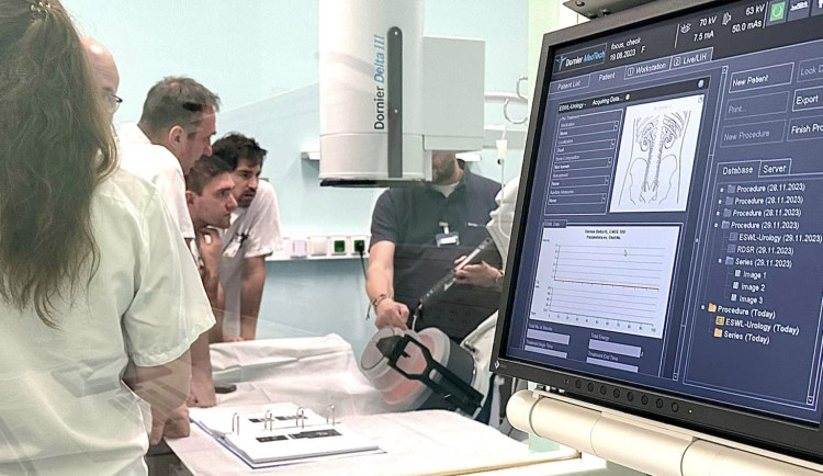 Urologové získali nový přístroj pro léčbu ledvinových a močových kamenů