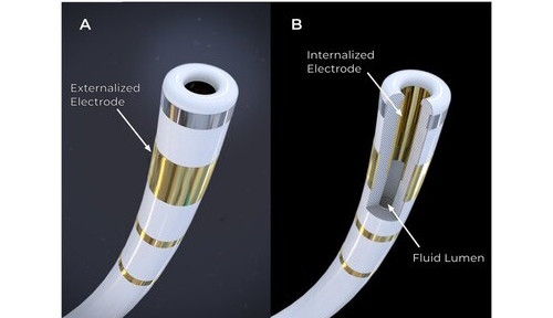 Field Medical oznamuje první klinické zkoušky revoluční technologie FieldForce™ pro ablaci komor pulzním polem