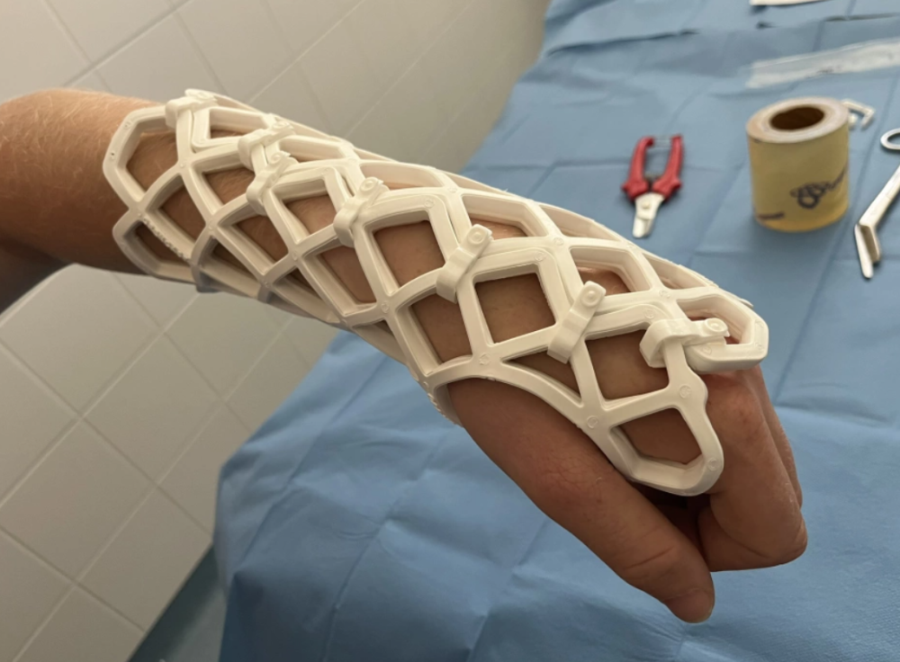 Průlom v léčbě zlomenin. V ostravské fakultní nemocnici je namísto sádry fixují ortézou z uhlíkových vláken