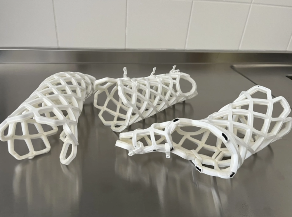 Průlom v léčbě zlomenin. V ostravské fakultní nemocnici je namísto sádry fixují ortézou z uhlíkových vláken