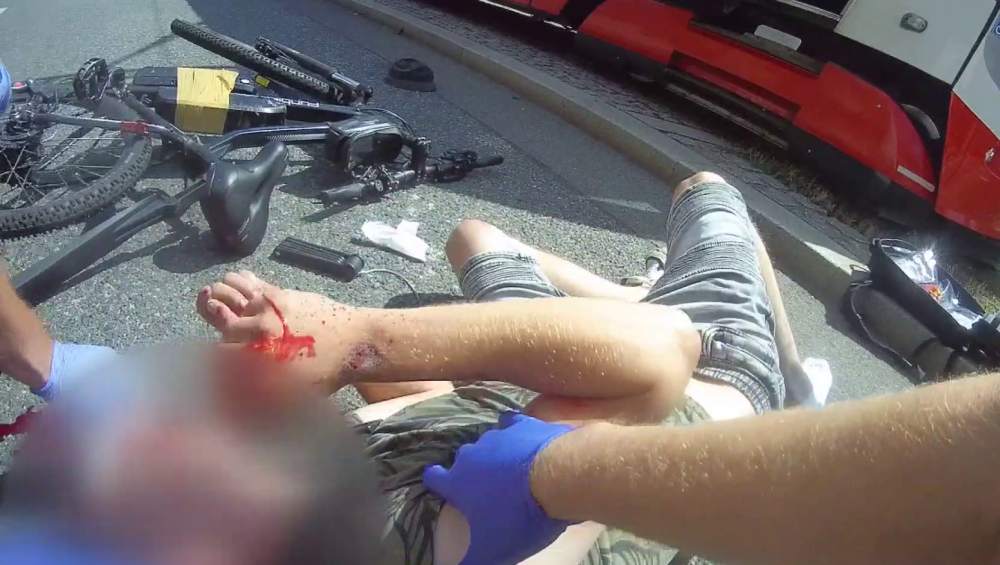 Muž krvácel z hlavy a nosu.