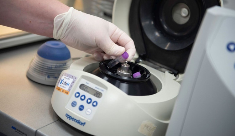Genetické testování odhaluje rizika nádorů prsu či vaječníků
