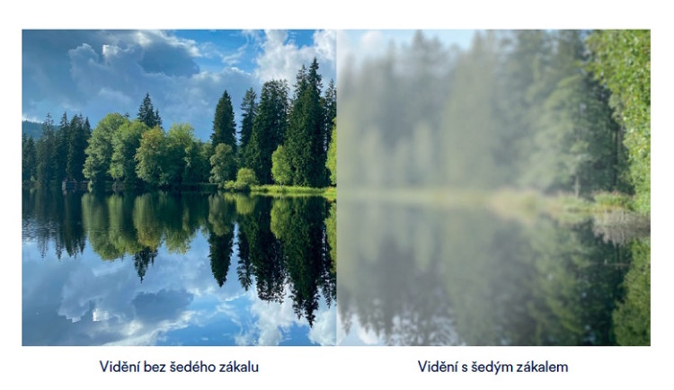 Šedý vs. zelený zákal. Klíčové rozdíly, které je důležité znát