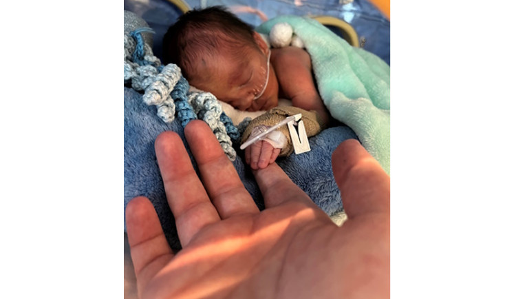 Jemný dotek a přesně padnoucí plenka jsou pro předčasně narozená miminka velice důležité