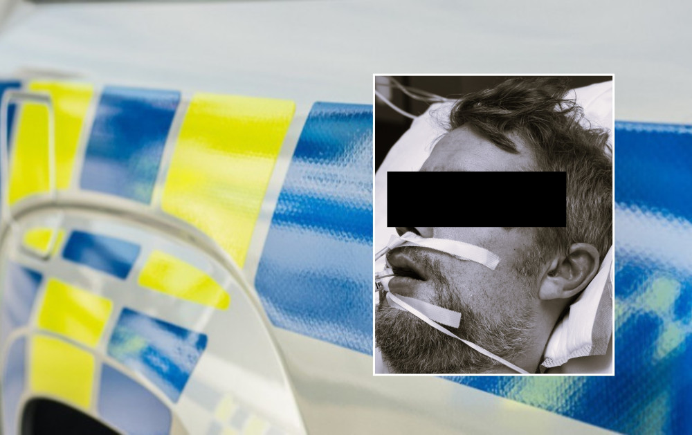 Zemřel surově zbitý muž, kterého našli ležet bez bot na ulici, případu se věnují kriminalisté