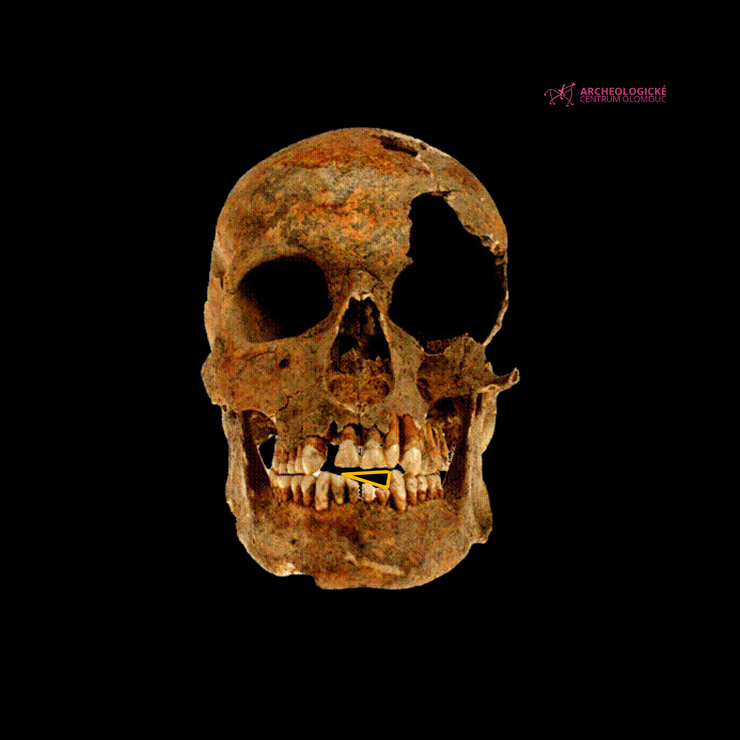 Voják z Majetína používal zuby k otevírání nábojů. Olomoučtí archeologové přišli s unikátním zjištěním