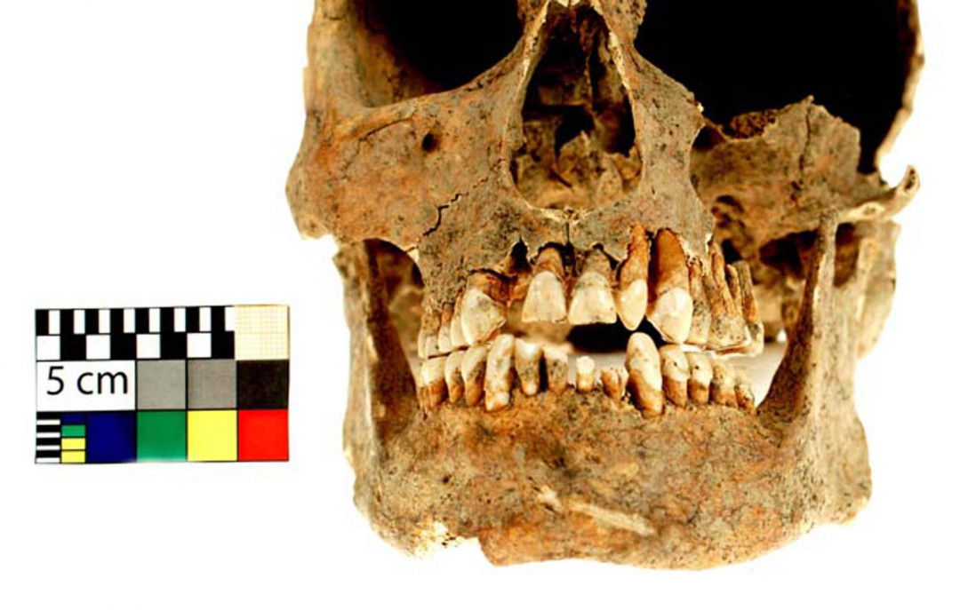 Voják z Majetína používal zuby k otevírání nábojů. Olomoučtí archeologové přišli s unikátním zjištěním