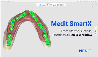 Revoluce v All-on-X: Převratná procedura společnosti Medit míří na trh