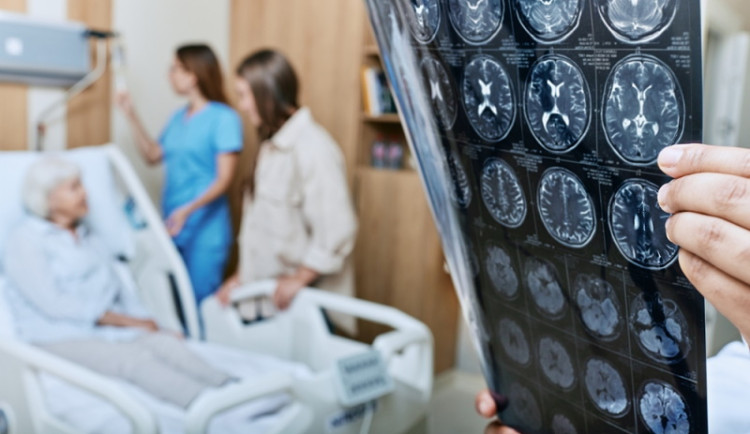 Alzheimerova demence: Dědičnost hraje roli!