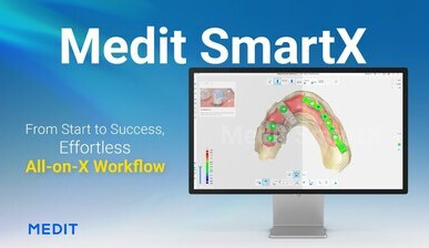 Medit představuje Medit SmartX – nové řešení pro All-on-X
