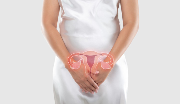 Endometrióza: jak léčit nepřítele ženského zdraví a plodnosti