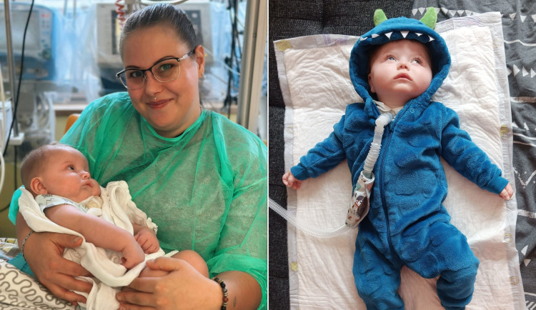 Maličký Jiřík trpí vzácnou a neléčitelnou genetickou poruchou. Má ji jen několik desítek lidí na světě