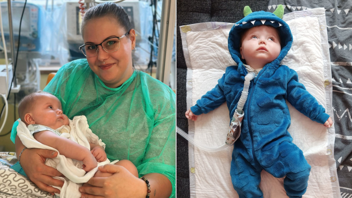 Maličký Jiřík trpí vzácnou genetickou poruchou. Má ji jen několik desítek lidí na světě