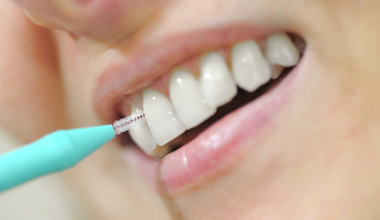Tajná zbraň proti zubnímu kazu? Zkuste mezizubní kartáček