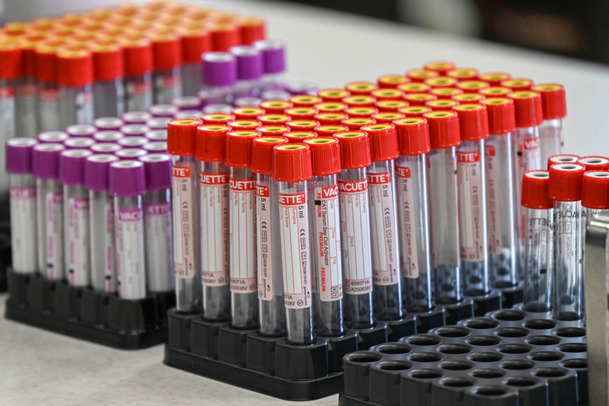 Hradecký kraj otevřel v Oblastní nemocnici Trutnov novou budovu laboratoří