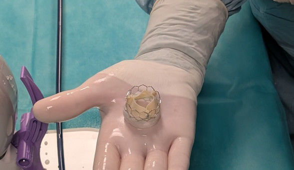 Lékaři v Brně pomáhají lidem se srdeční vadou. Letos implementovali 250 chlopní