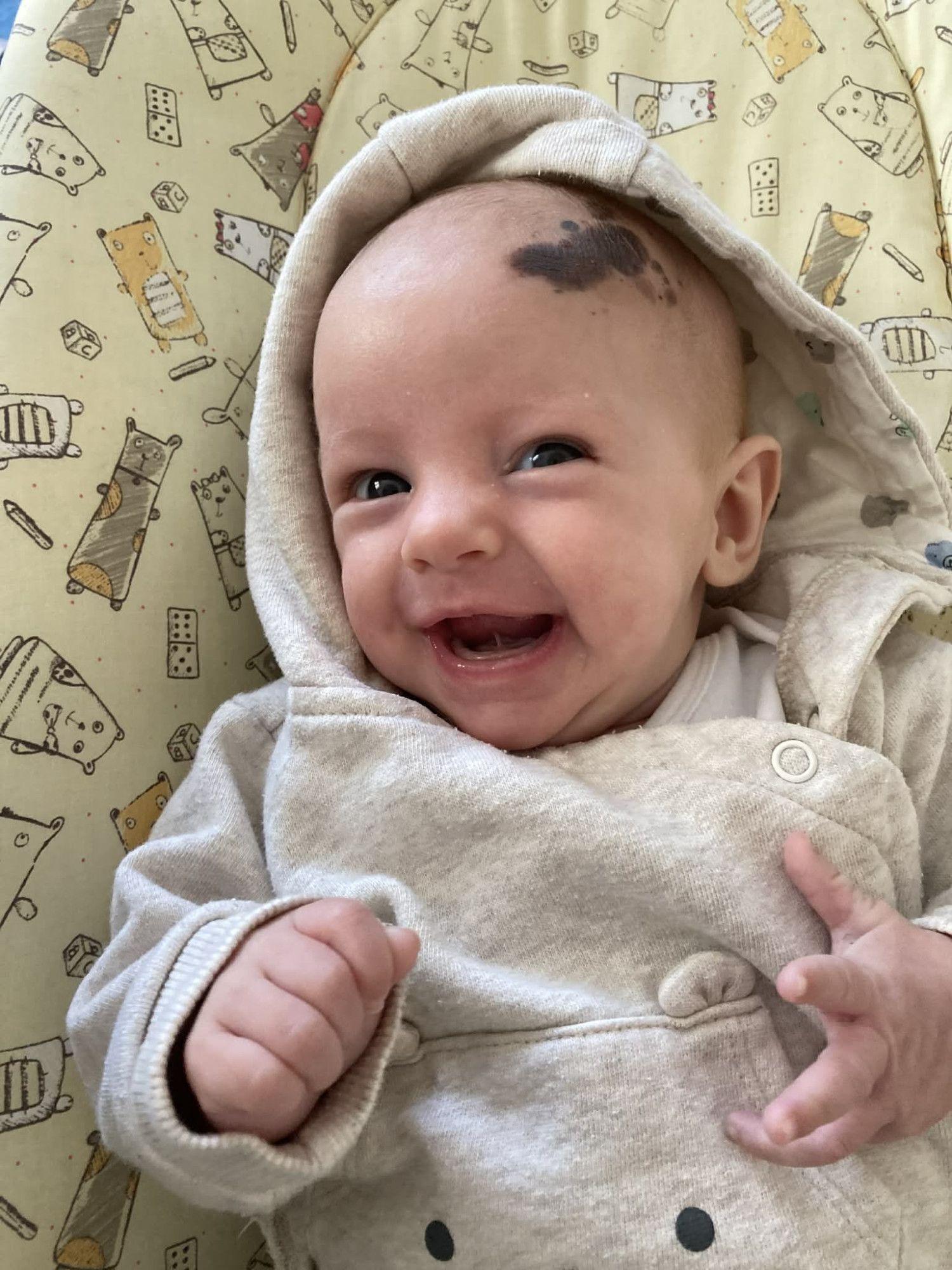 Anežka bojuje se vzácným typem rakoviny, rodina žádá o pomoc s financováním nákladné léčby