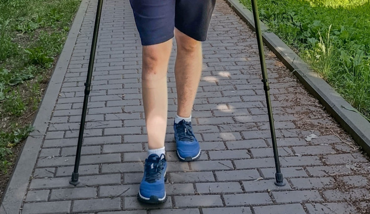Lékaři z Olomouce umí prodloužit končetinu o několik centimetrů. Používají titanové hřeby
