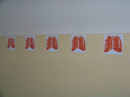 Tapety s motivem plic, pozůstatek Wolkerova sanatoria.