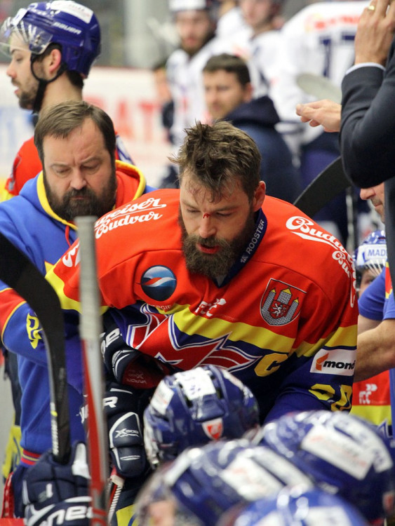 Krvavý šrám v obličeji Zdeňka Kutláka