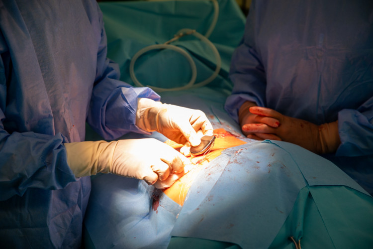 FOTOGALERIE: Odborníci z FN Olomouc zavádějí pacientovi nový stimulátor tišící bolest