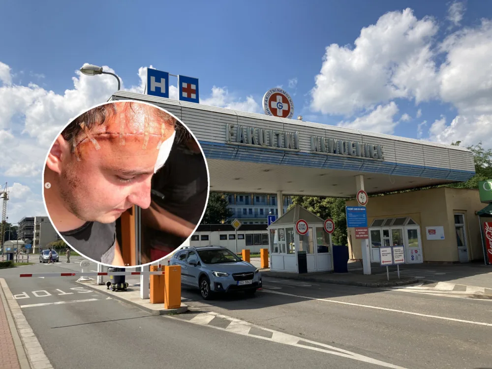 Hradecká neurochirurgická klinika slaví 70. výročí. Například Petr šel na sál náhodou, po skoku do bazénu.