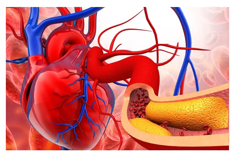 Dědičně zvýšený cholesterol je hrozba, Češi ho příliš neřeší