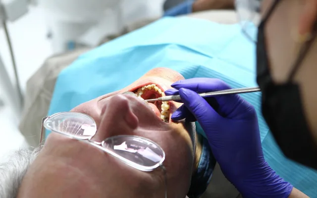 Rakovinou dutiny ústní ročně onemocní až 700 lidí, polovina z nich zemře