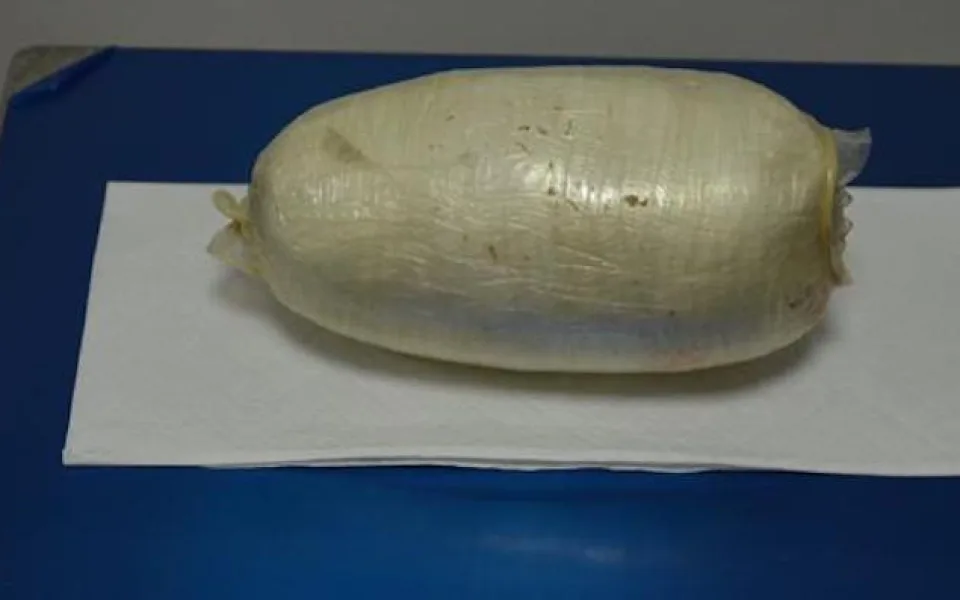 Brazilka pašovala ve svých útrobách kokain. Celníkům musel pomoci až gynekolog.