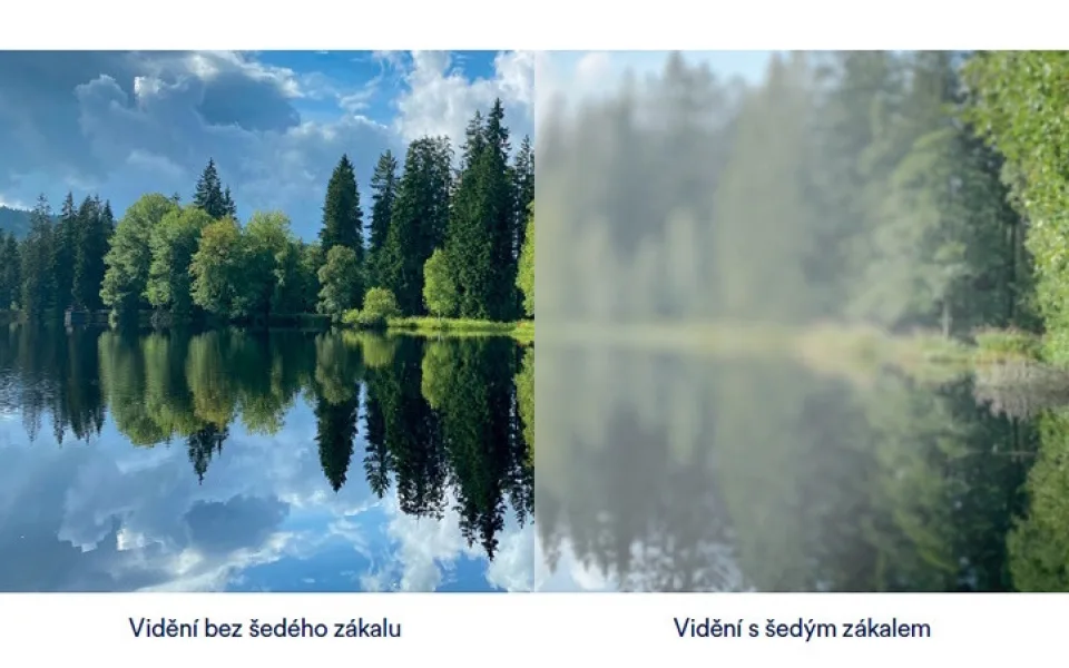Šedý vs. zelený zákal. Klíčové rozdíly, které je důležité znát